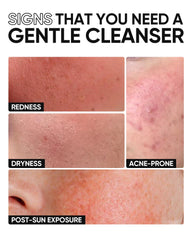 Soft foam texture of SKINTIFIC cleanser for gentle cleansing.