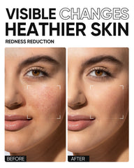 SKINTIFIC Face Moisturizer with hyaluronic acid infusion provides long-lasting hydration without heaviness.