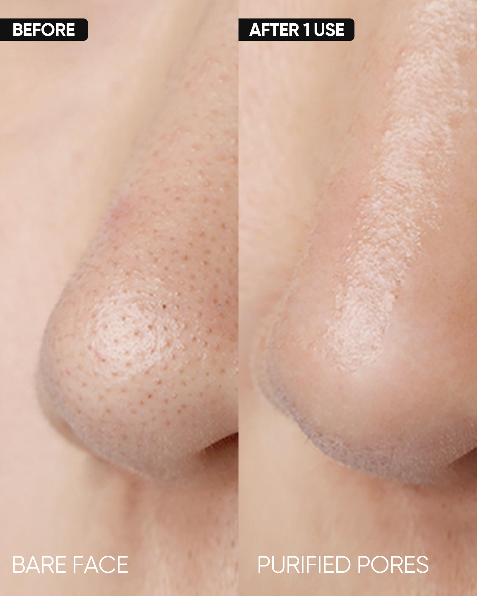 SKINTIFIC glycolic acid gently dissolves dead cells for gentle exfoliation.