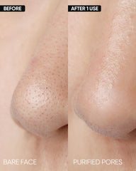 SKINTIFIC glycolic acid gently dissolves dead cells for gentle exfoliation.