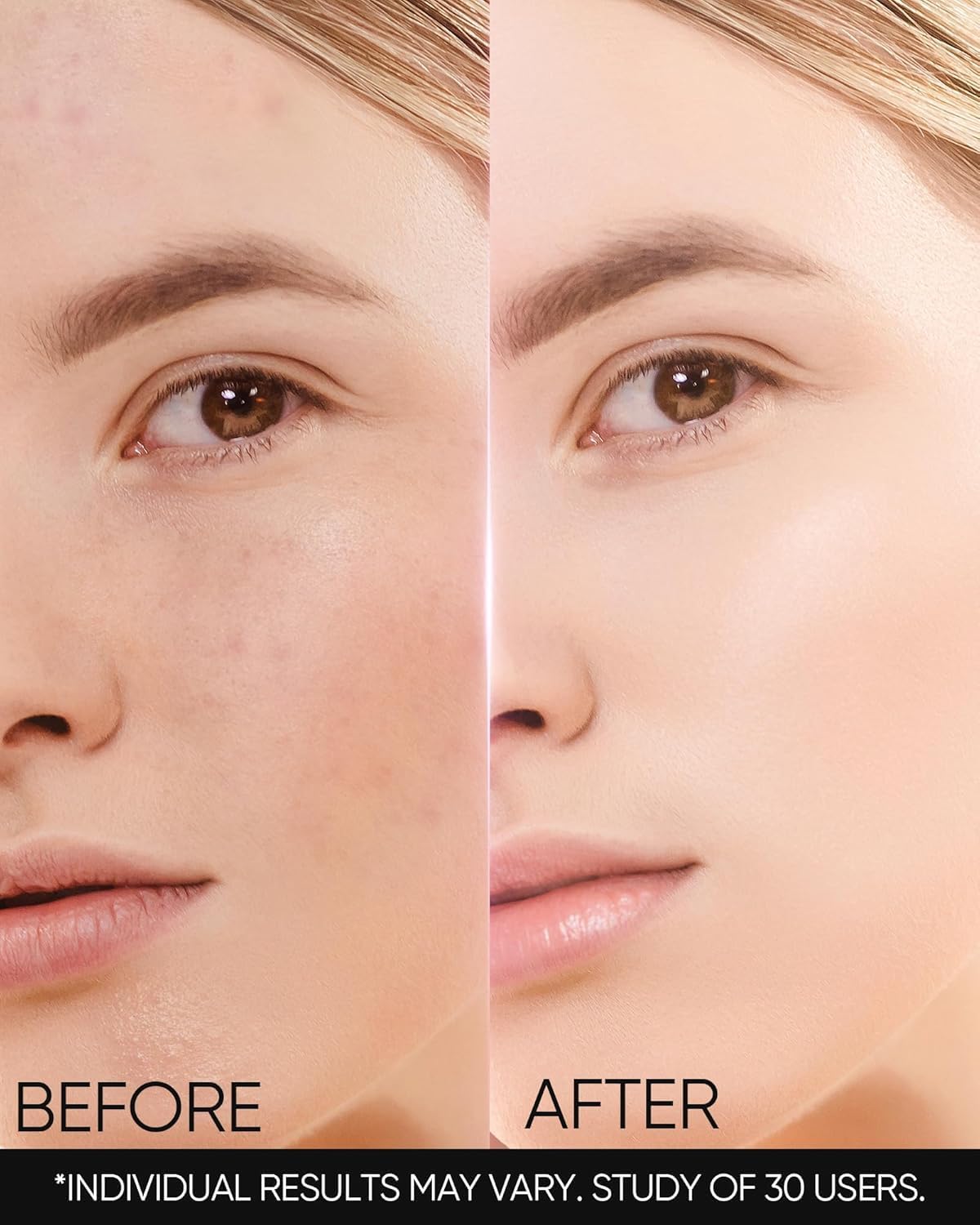 SKINTIFIC MSH Cream spread on skin shows smooth, non-greasy finish