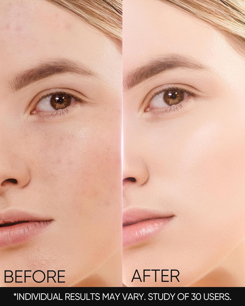 SKINTIFIC MSH Cream spread on skin shows smooth, non-greasy finish