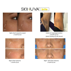 Lifestyle shot of someone applying Skinuva Brite to the cheek for evening skin tone.