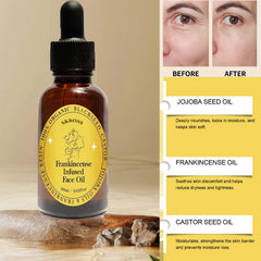 SKROSS frankincense resin oil ingredients blend highlighting natural oils for skin nourishment