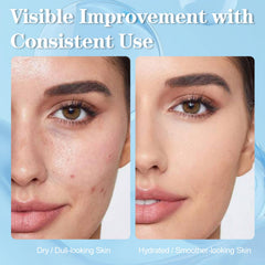 SKSOYT Copper Peptide Serum hyaluronic acid drop demonstrates deep hydration