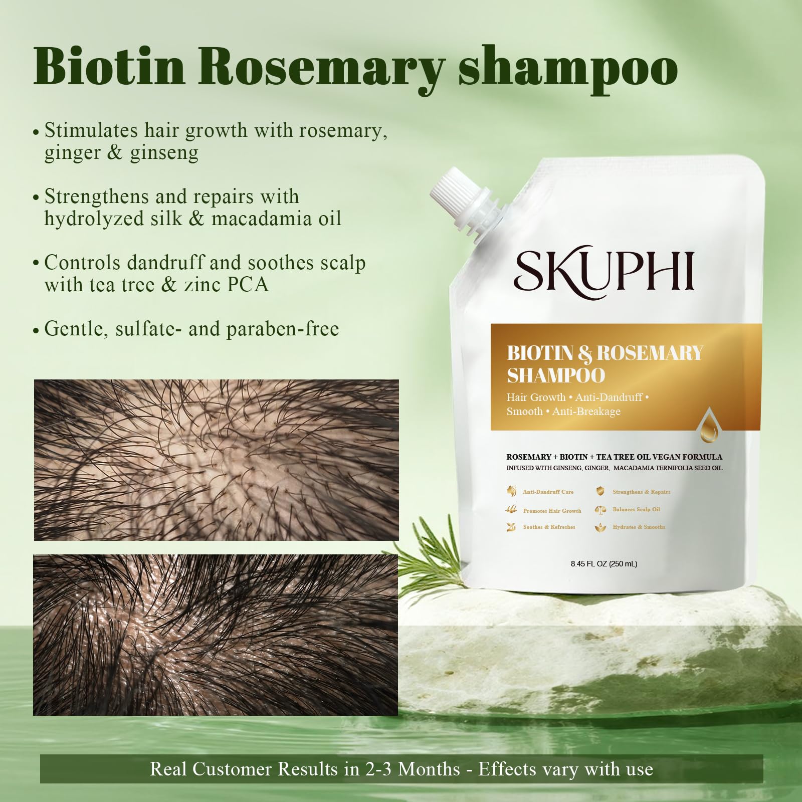 Creamy lather from SKUPHI Shampoo enriches hair texture during wash