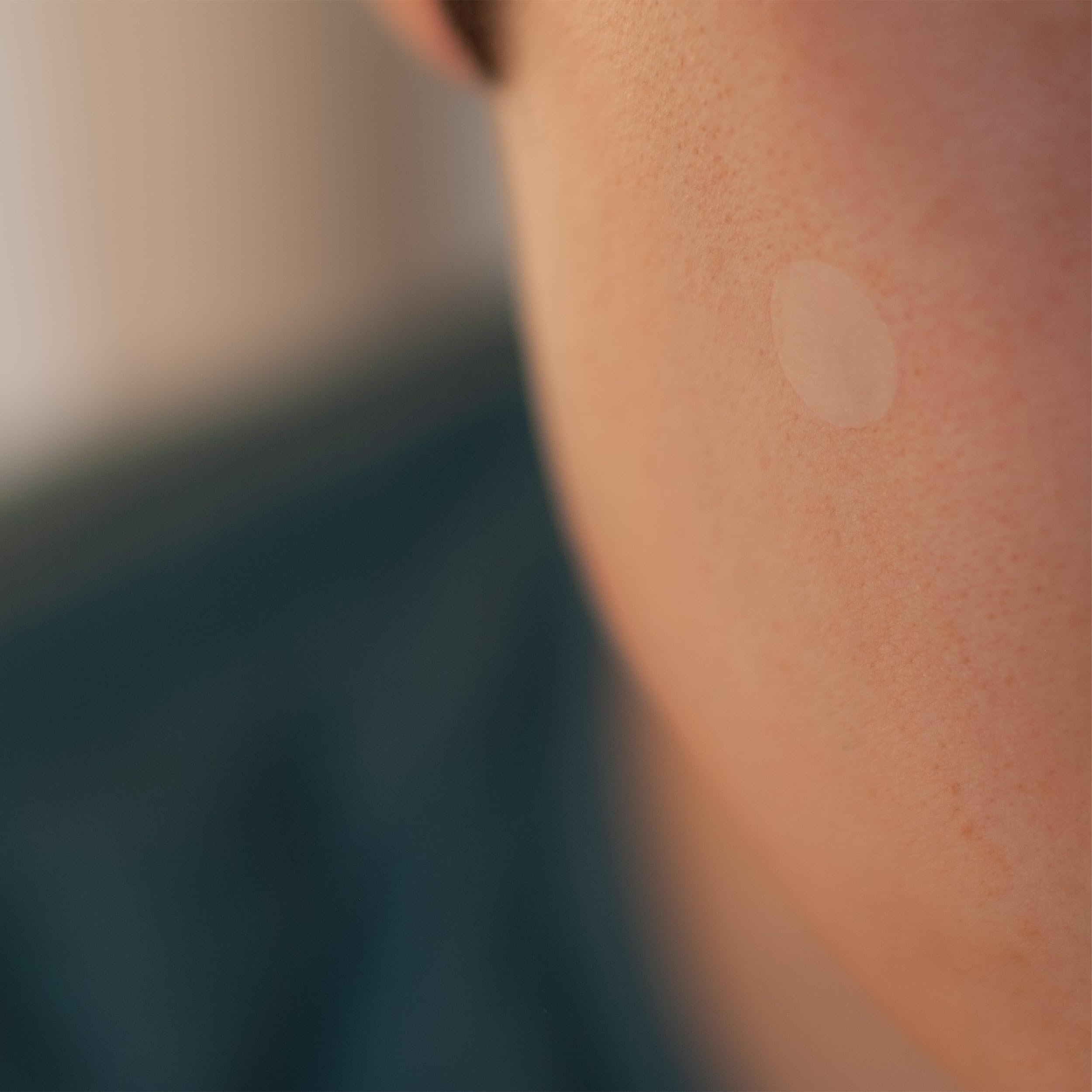 SMARTMED hydrocolloid close-up emphasizes absorption and protective coverage.