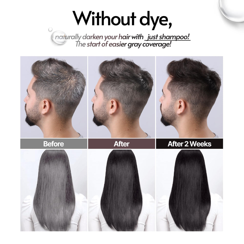 SMIB Lactobio probiotic-infused scalp care at hair roots.