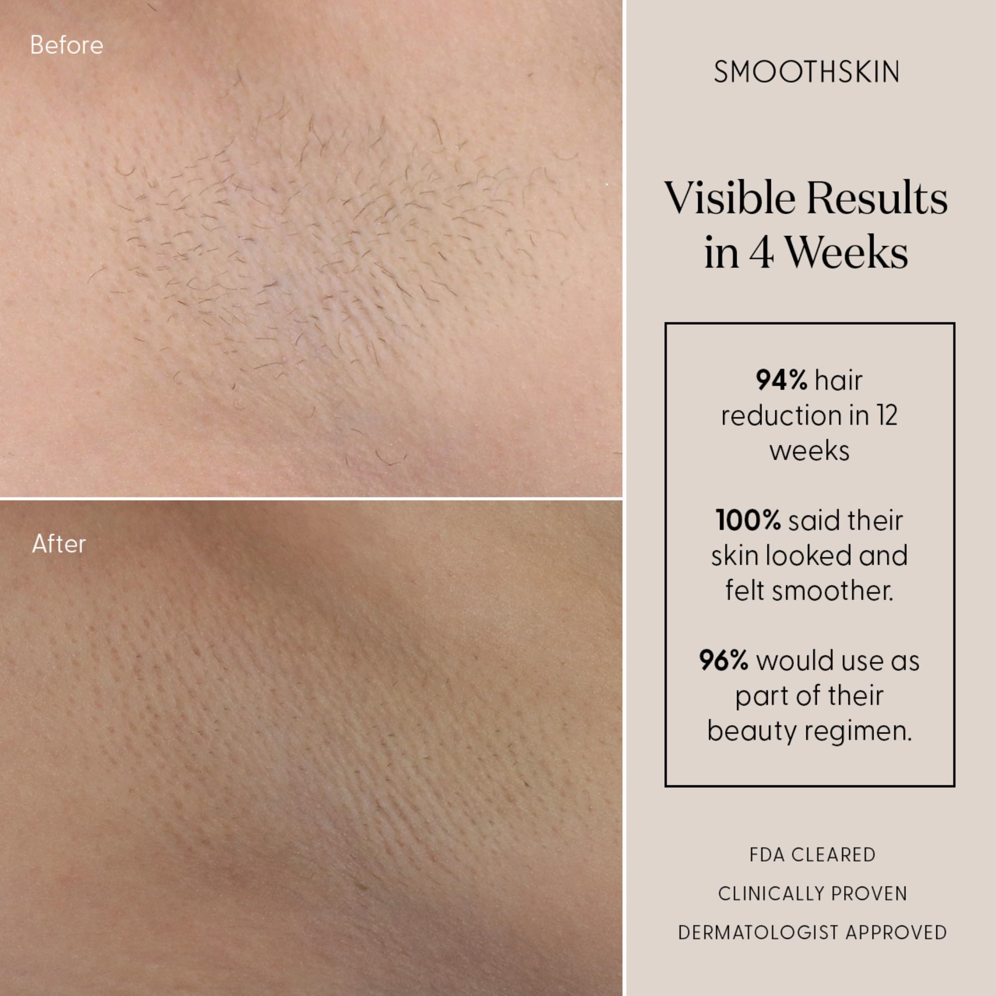 SMOOTHSKIN SmoothSkin Pure Mini underarm treatment during everyday grooming