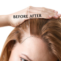 SNOB GIRLS Normadense 2 biotin-niacinamide-ceramides image highlights nourishing ingredients for healthy strands.