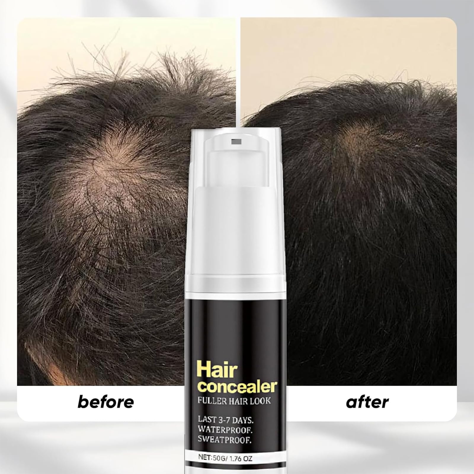 Soelegant hairline coverage closeup shows natural blend.