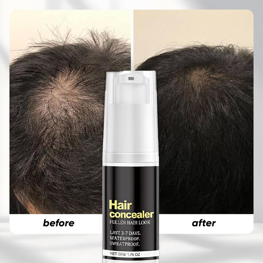 Soelegant hairline coverage closeup shows natural blend.