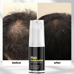 Soelegant hairline coverage closeup shows natural blend.