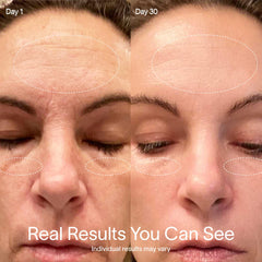 Solawave wand on cheek contours for depuffing and radiance