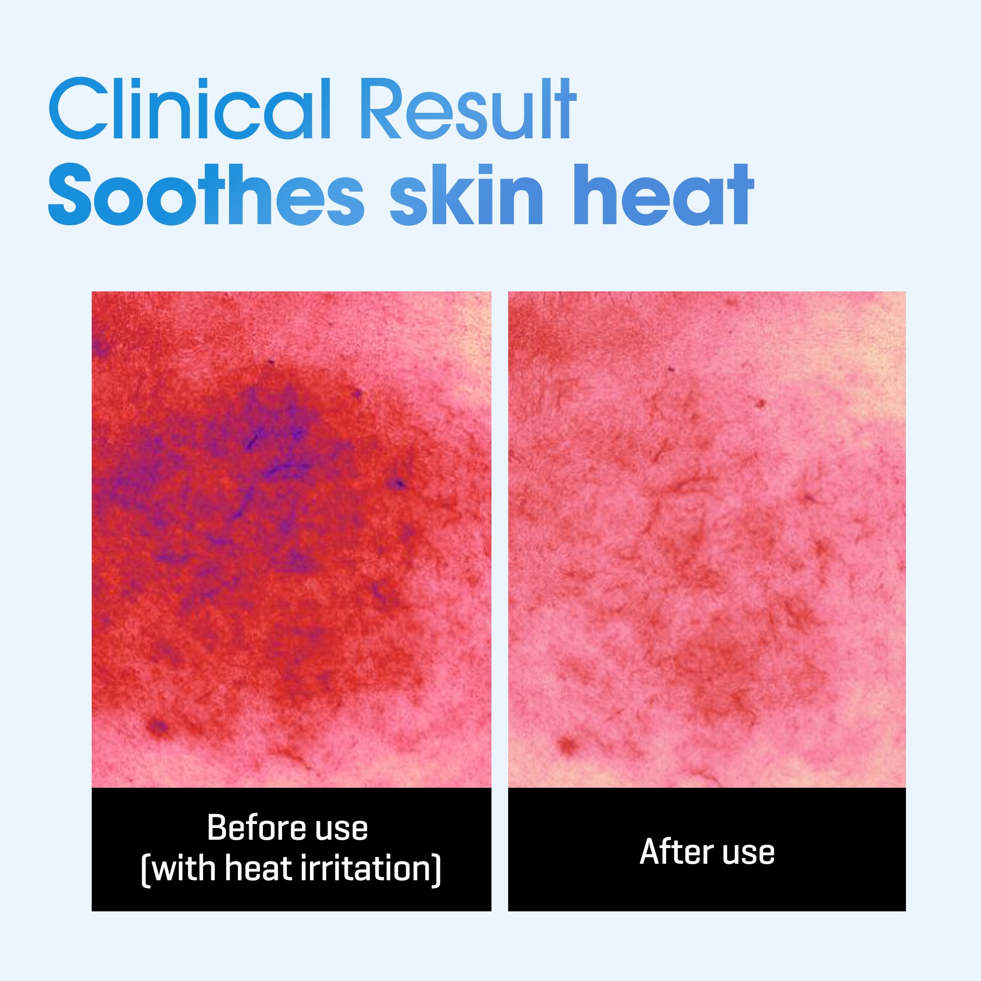 Opened SOME BY MI Beta-Panthenol sheet mask ready for soothing hydration.