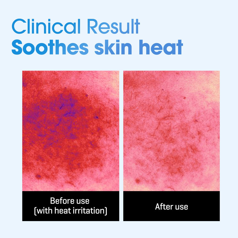 Opened SOME BY MI Beta-Panthenol sheet mask ready for soothing hydration.