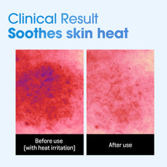 Opened SOME BY MI Beta-Panthenol sheet mask ready for soothing hydration.