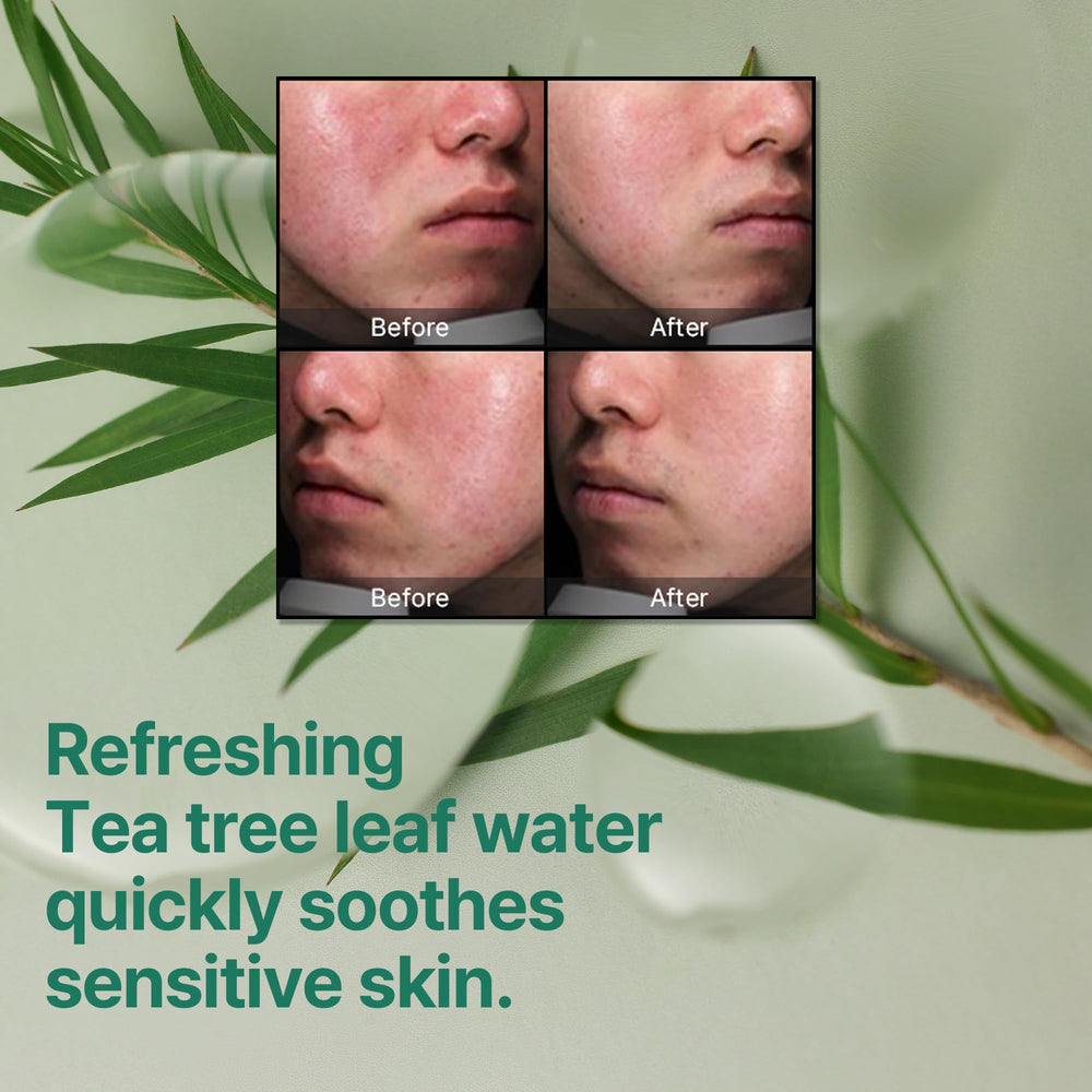 Some By Mi exfoliation benefits with AHA BHA PHA illustration