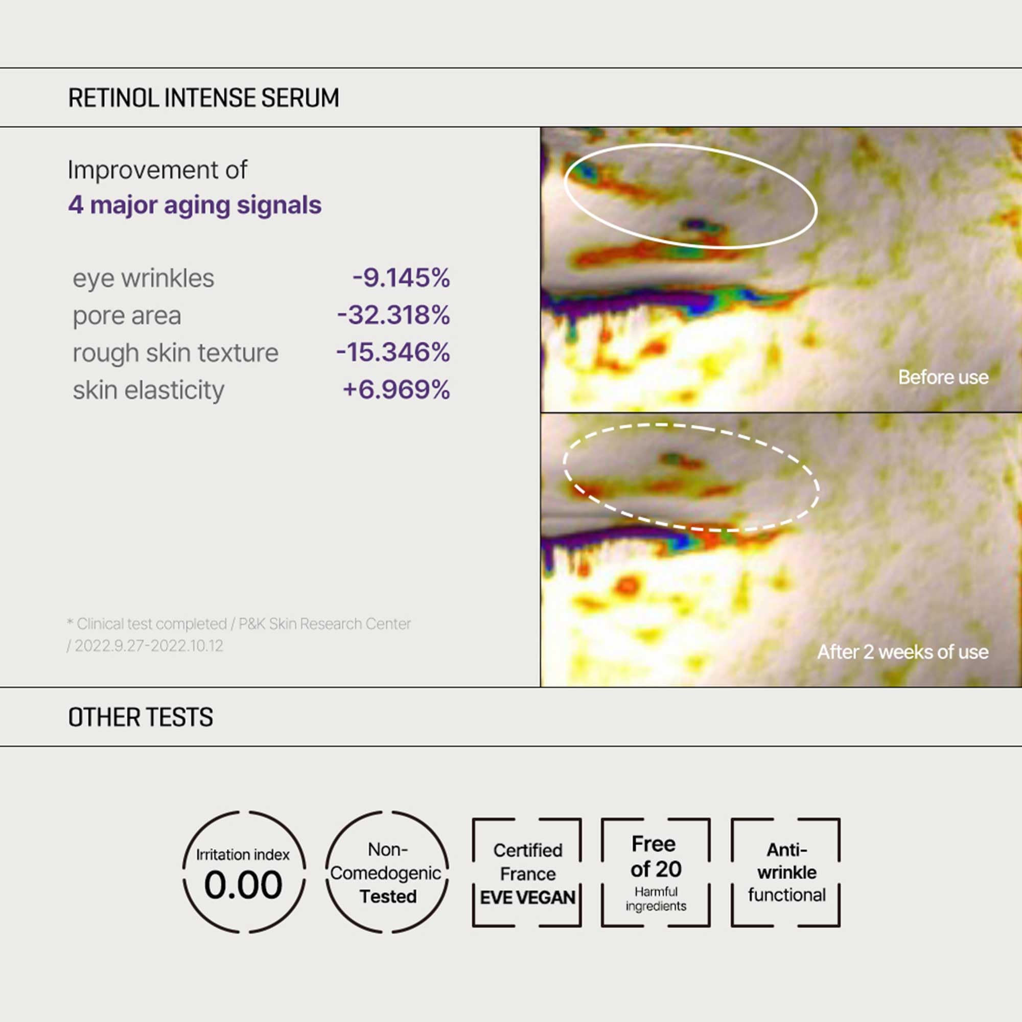 Application of SOME BY MI Retinol Eye Cream for under-eye care.