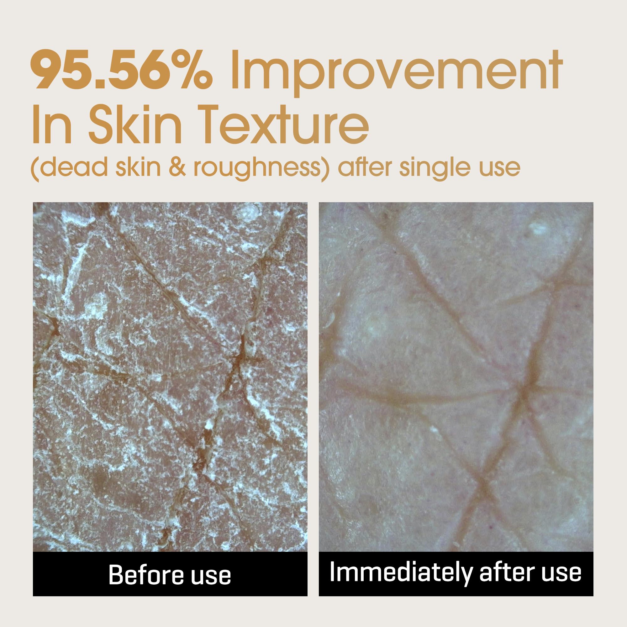 Rice-ceramide formula in SOME BY MI Galactomyces Glutathione Brightening Cream strengthens the barrier.