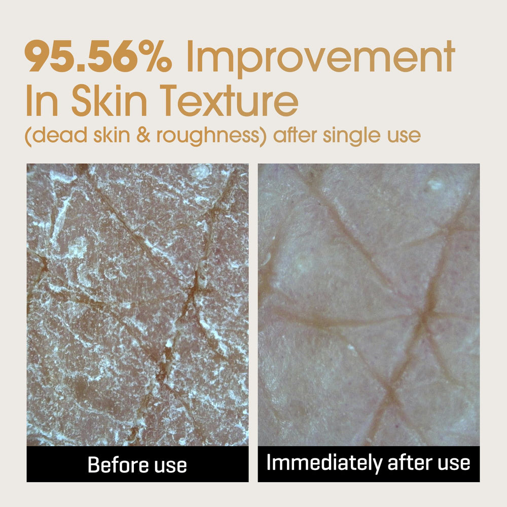 Rice-ceramide formula in SOME BY MI Galactomyces Glutathione Brightening Cream strengthens the barrier.