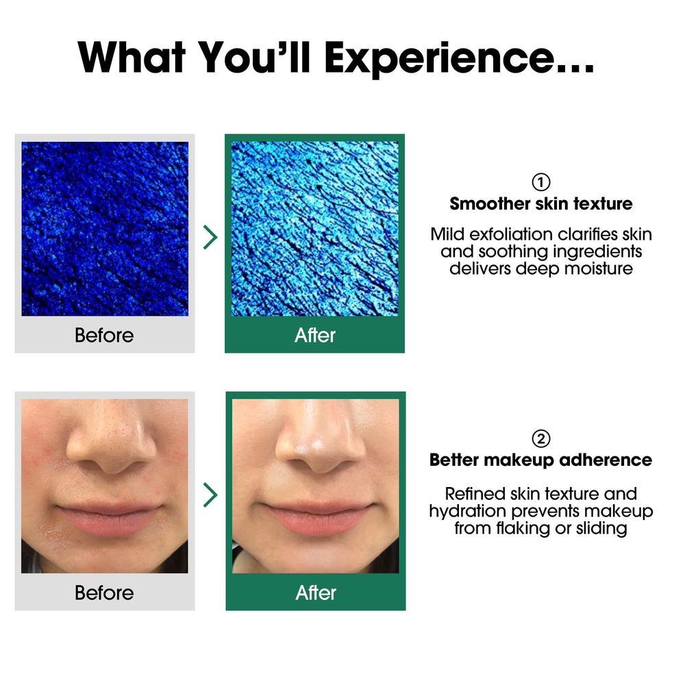 SOME BY MI toner with 2% Niacinamide improving texture and tone over time.