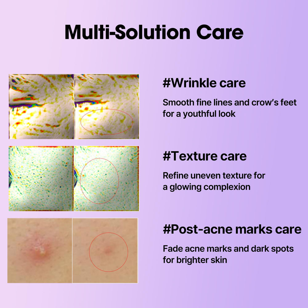 SOME BY MI Retinol Serum ingredients graphic featuring bakuchiol and ceramides.
