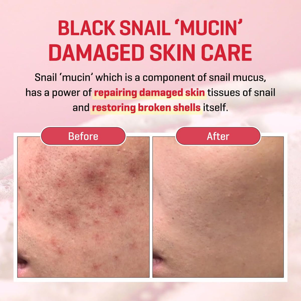 SOME BY MI Snail Trucica Serum ingredients snail mucin for moisture and soothing care
