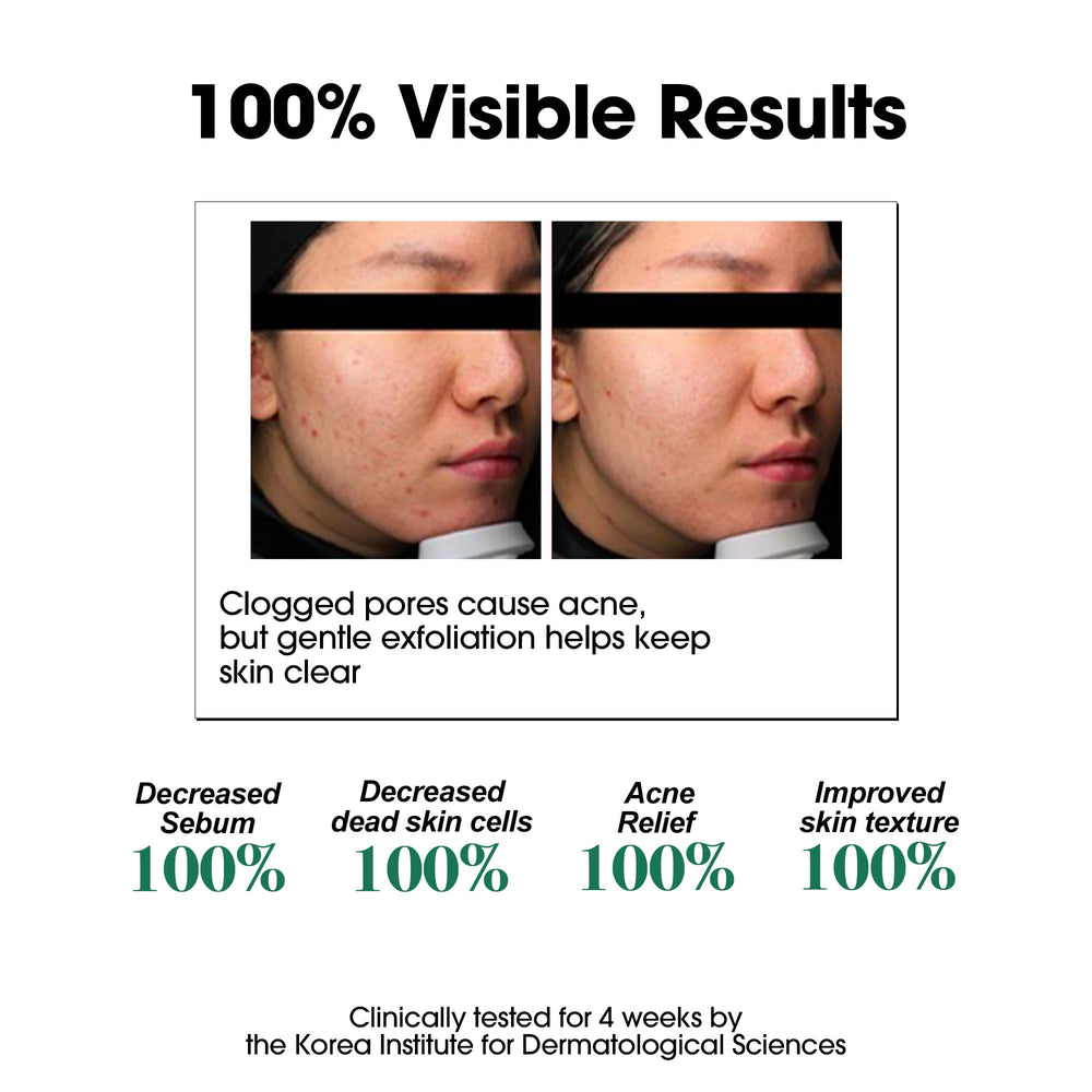 SOME BY MI Miracle Toner bottle demonstrates calming formula for balanced skin.