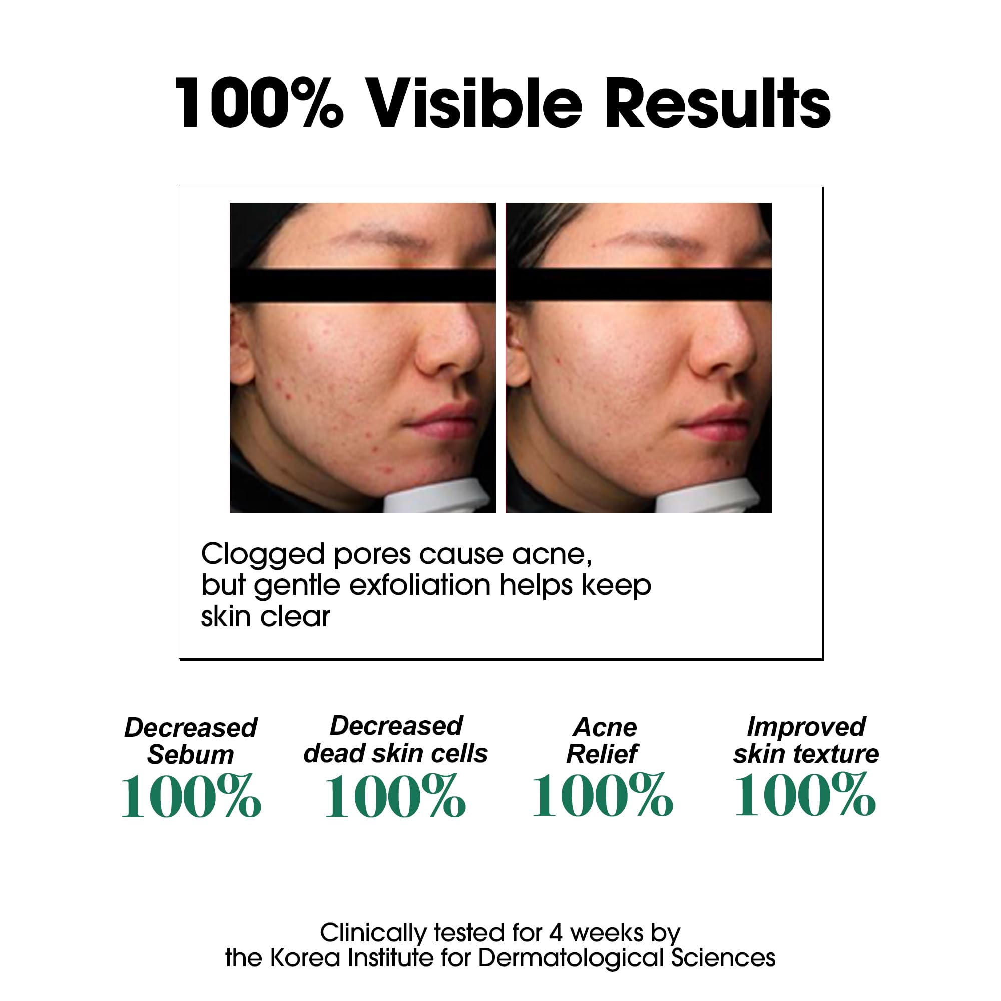 Tea tree imagery on SOME BY MI toner suggesting soothing care