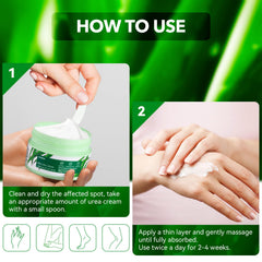 Sonobom Urea Cream on hands and elbows softens rough skin