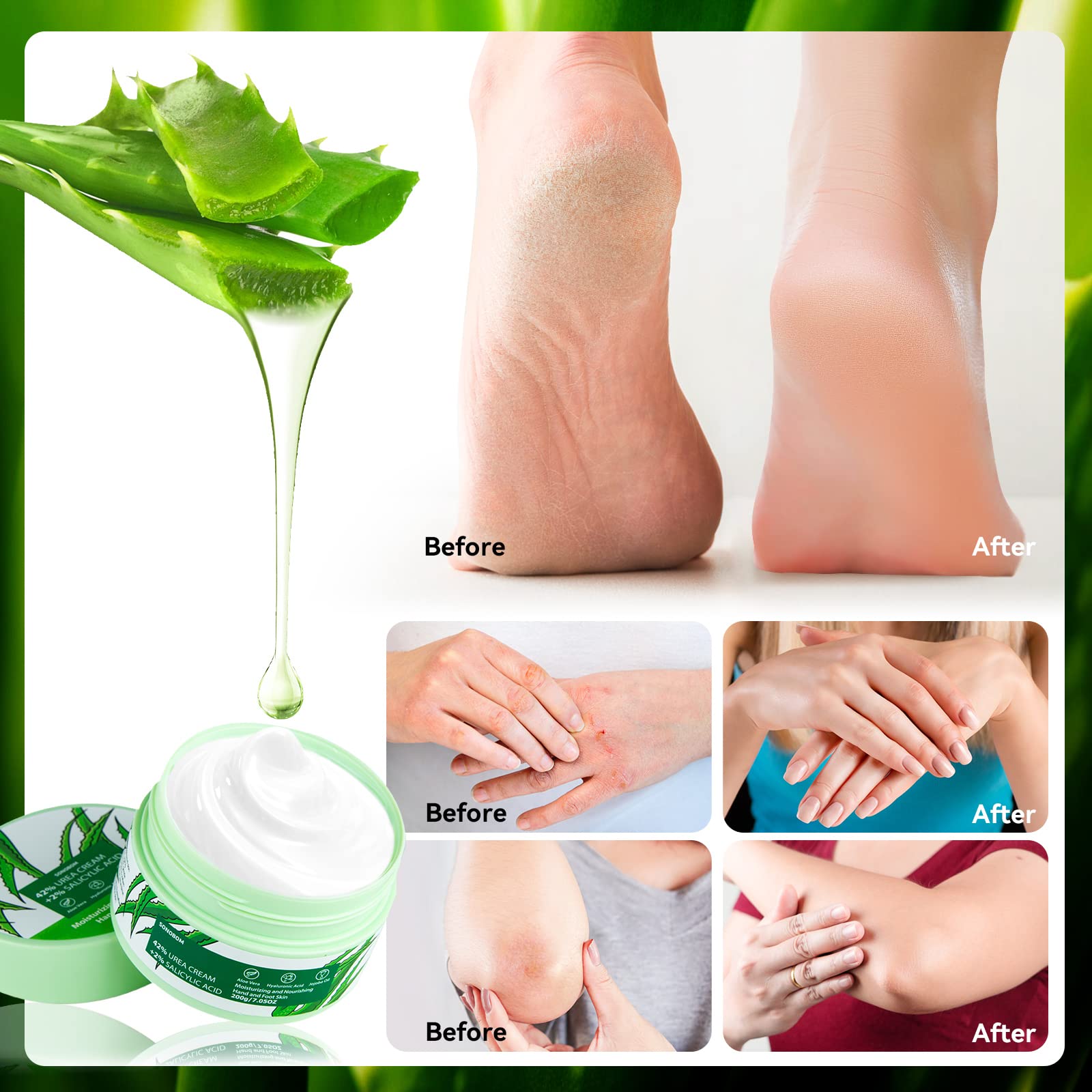 Sonobom Urea Cream with natural ingredients nourishes with jojoba and avocado oils