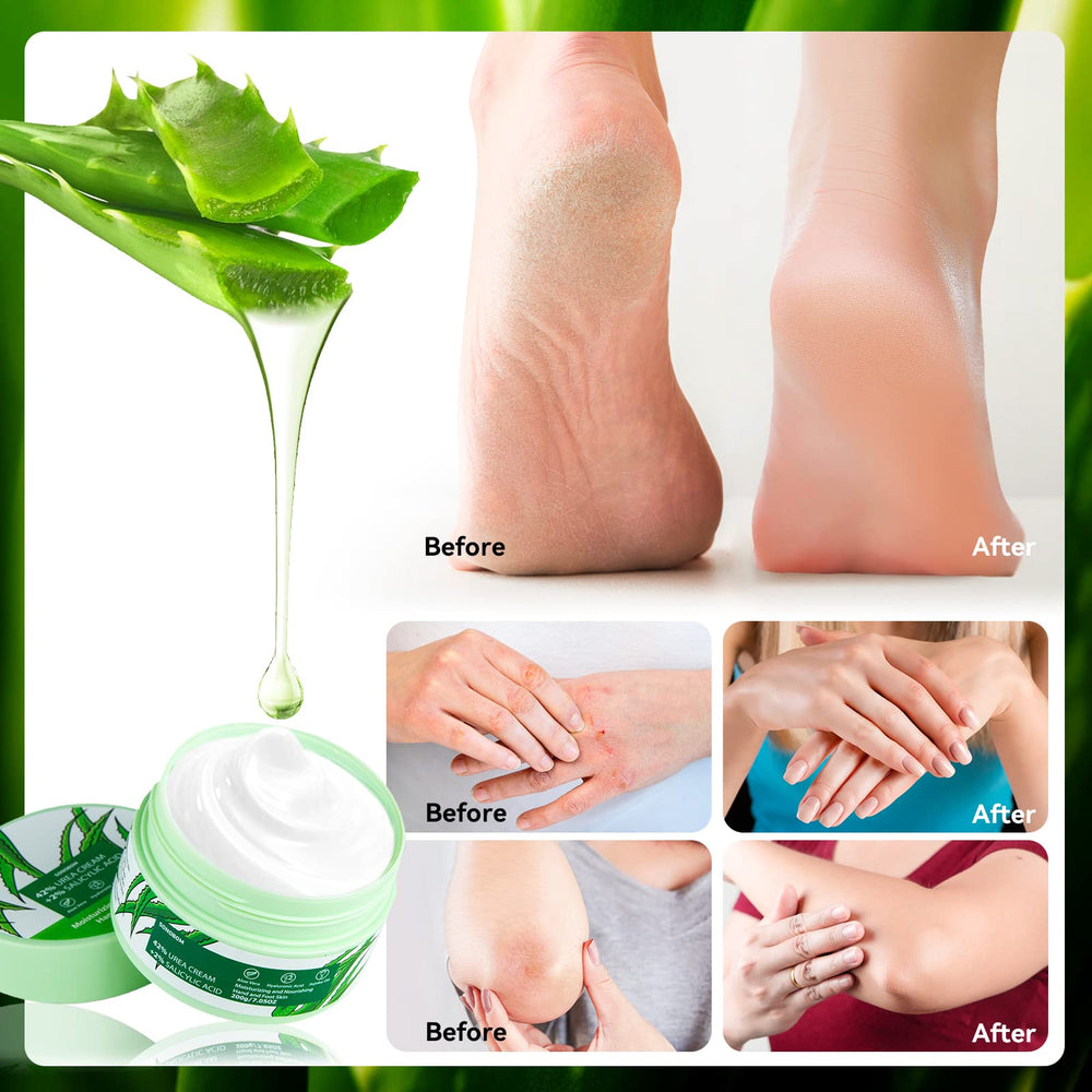 Sonobom Urea Cream with natural ingredients nourishes with jojoba and avocado oils