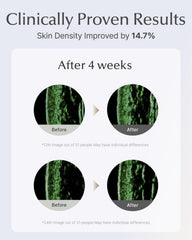Sooryehan Lifting Ampoule Serum with 5% Niacinamide supports even skin tone