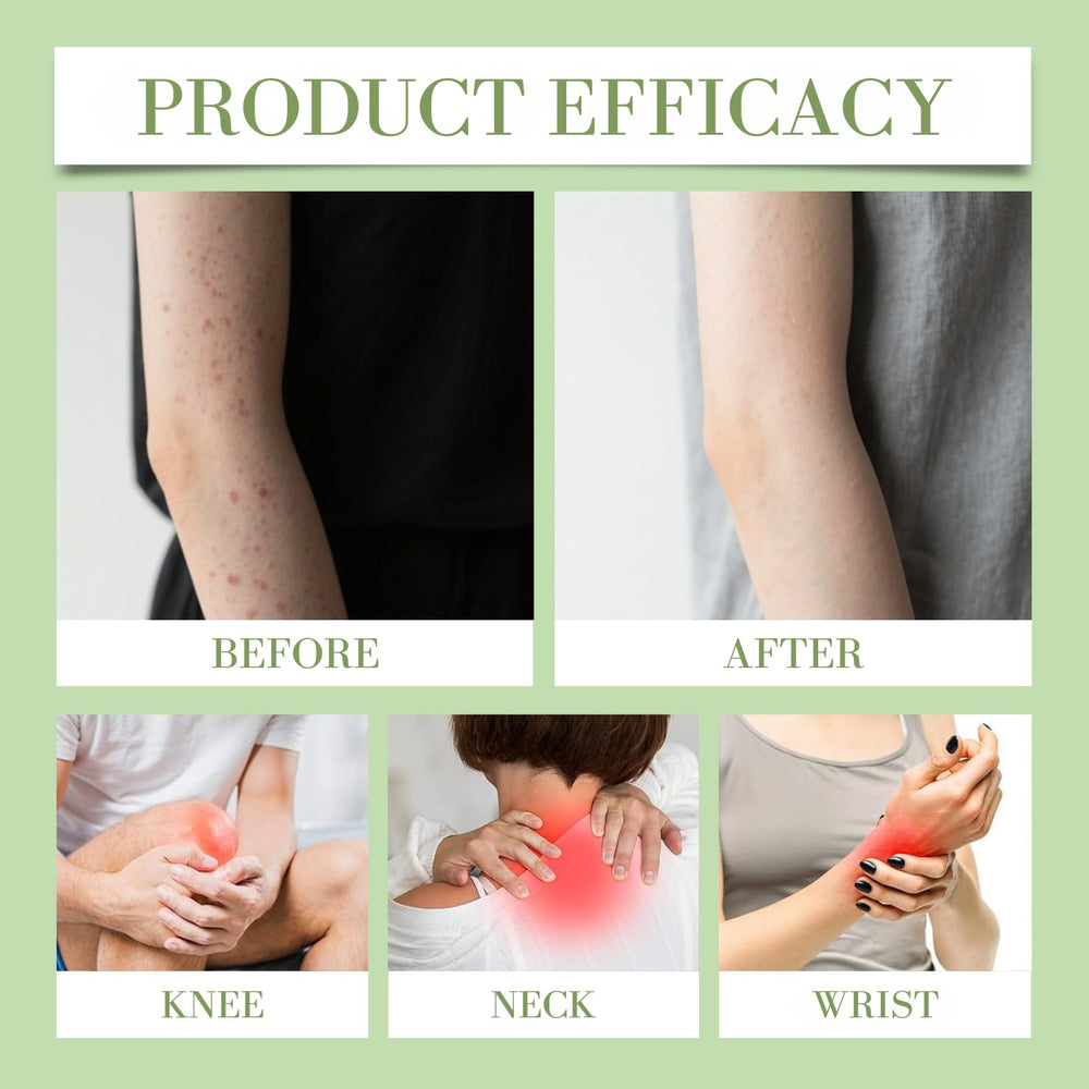Soothing Relief Cream on dry skin areas like elbows and knees