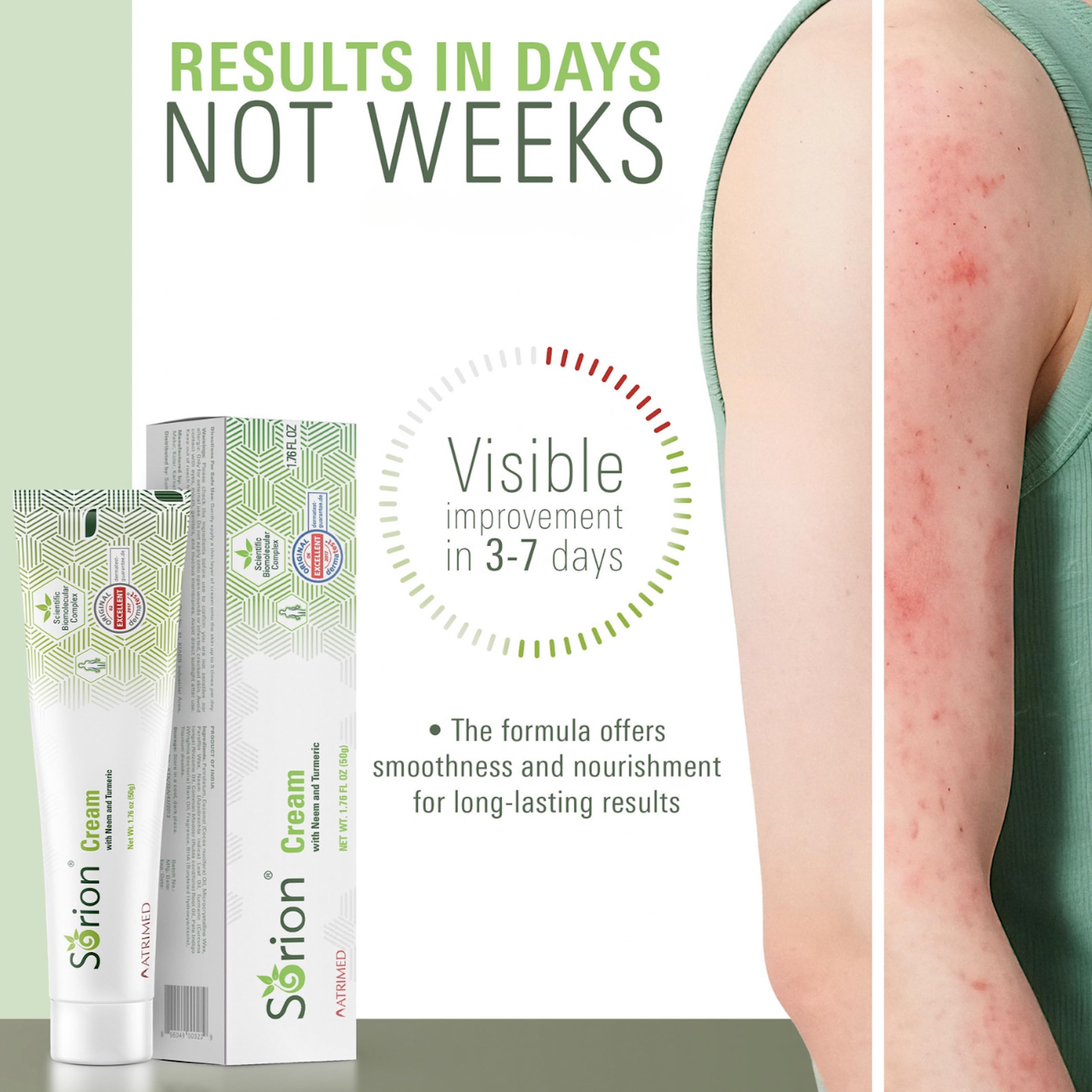 Sorion Cream hand application demonstrates quick absorption and hydration.