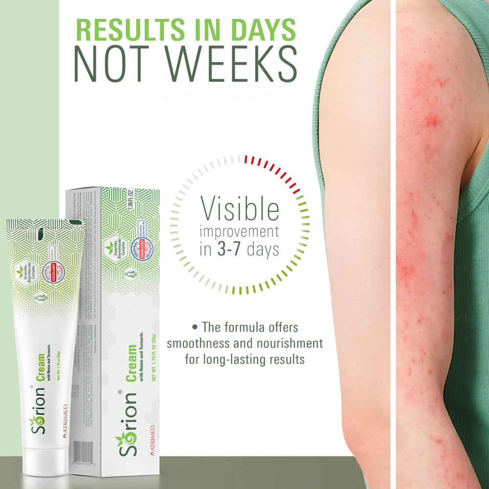 Sorion Cream hand application demonstrates quick absorption and hydration.