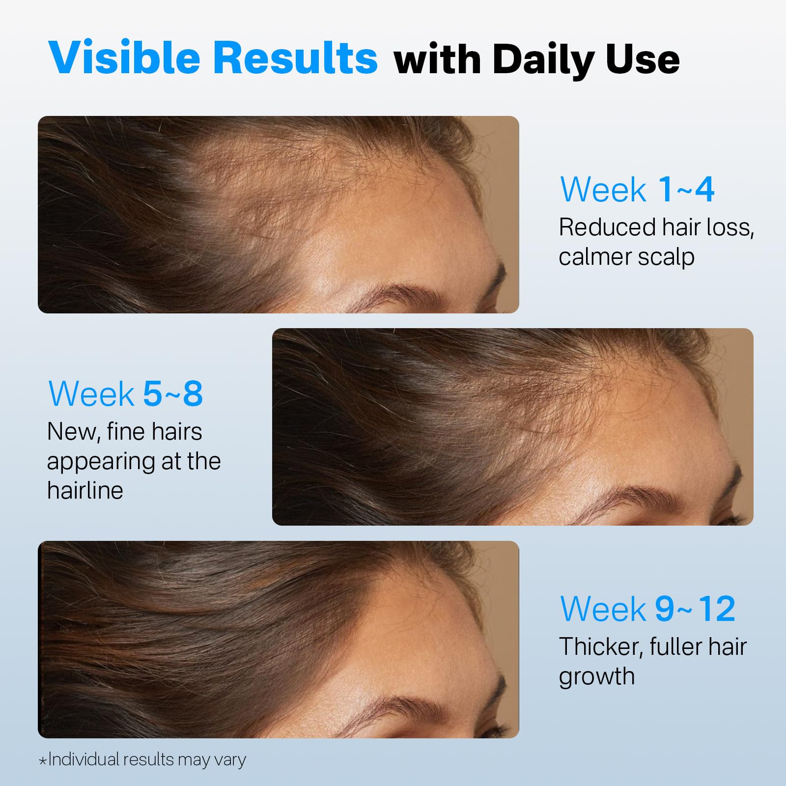 SORNBEO daily-use serum suitable for all hair types