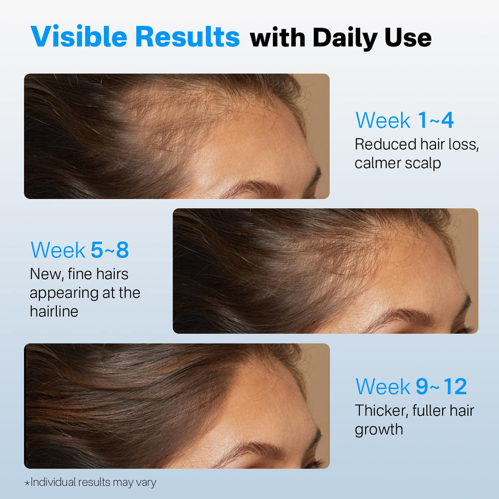 SORNBEO daily-use serum suitable for all hair types
