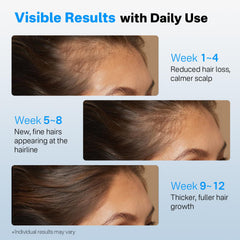 SORNBEO daily-use serum suitable for all hair types