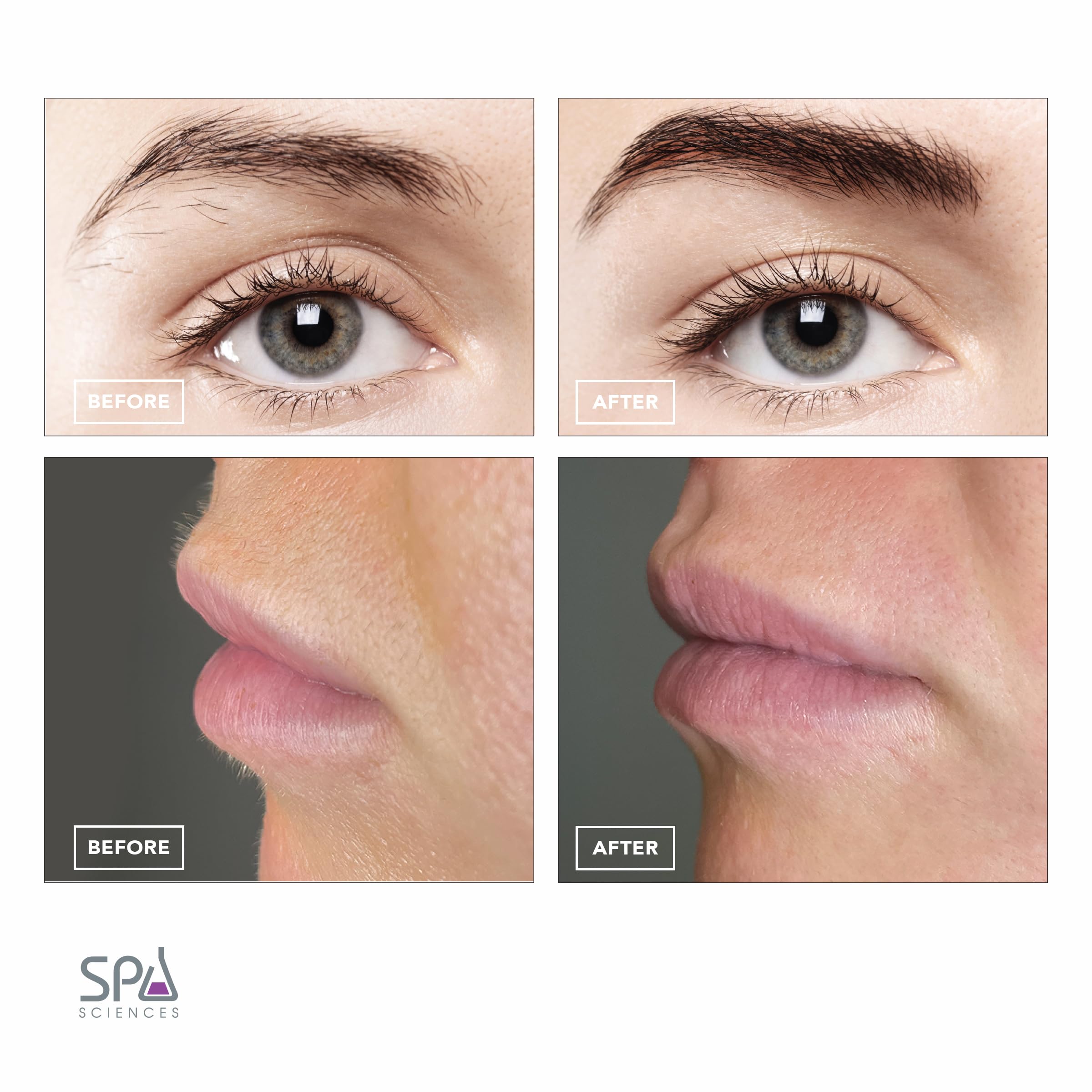 SPA SCIENCES AIVA painless facial hair removal for smooth skin.