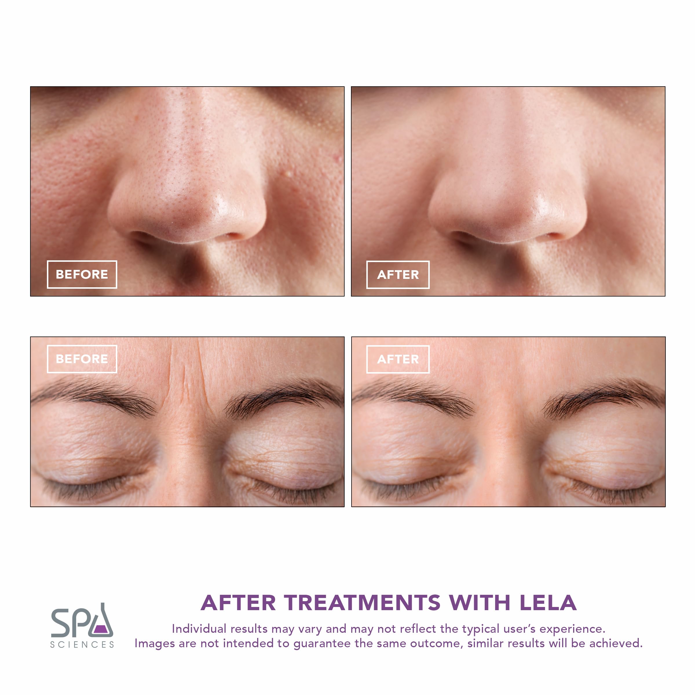 Spa Sciences LELA serum infusion mode enhances absorption of skincare products.