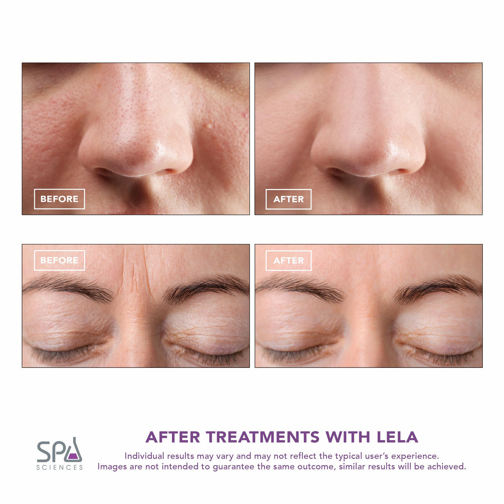 Spa Sciences LELA serum infusion mode enhances absorption of skincare products.