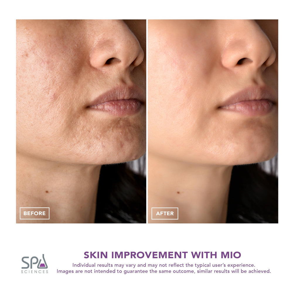 Spa Sciences MIO pore-refinement visual focus for clearer-looking skin.