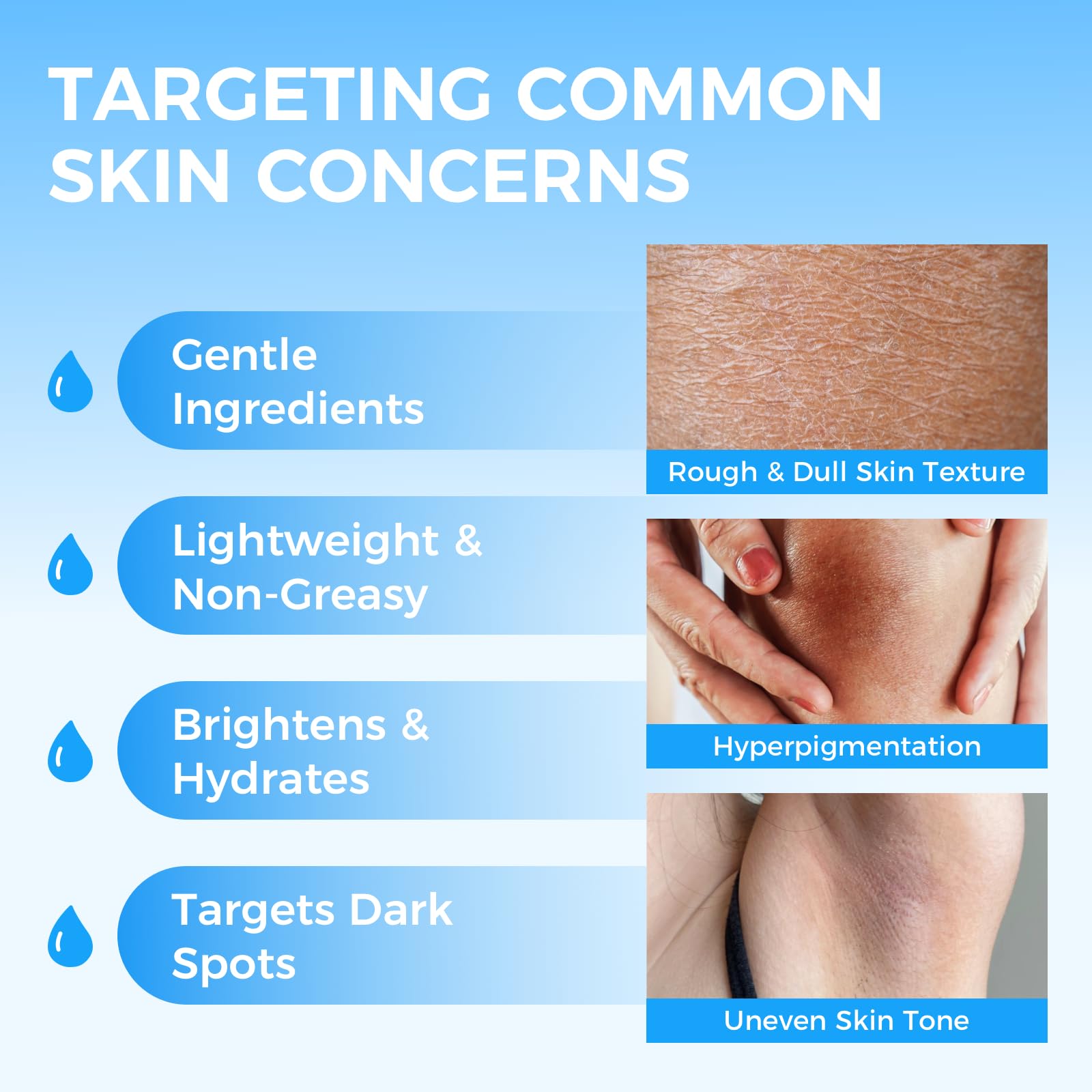 Sperandi bikini-line application showing gentle, targeted brightening.