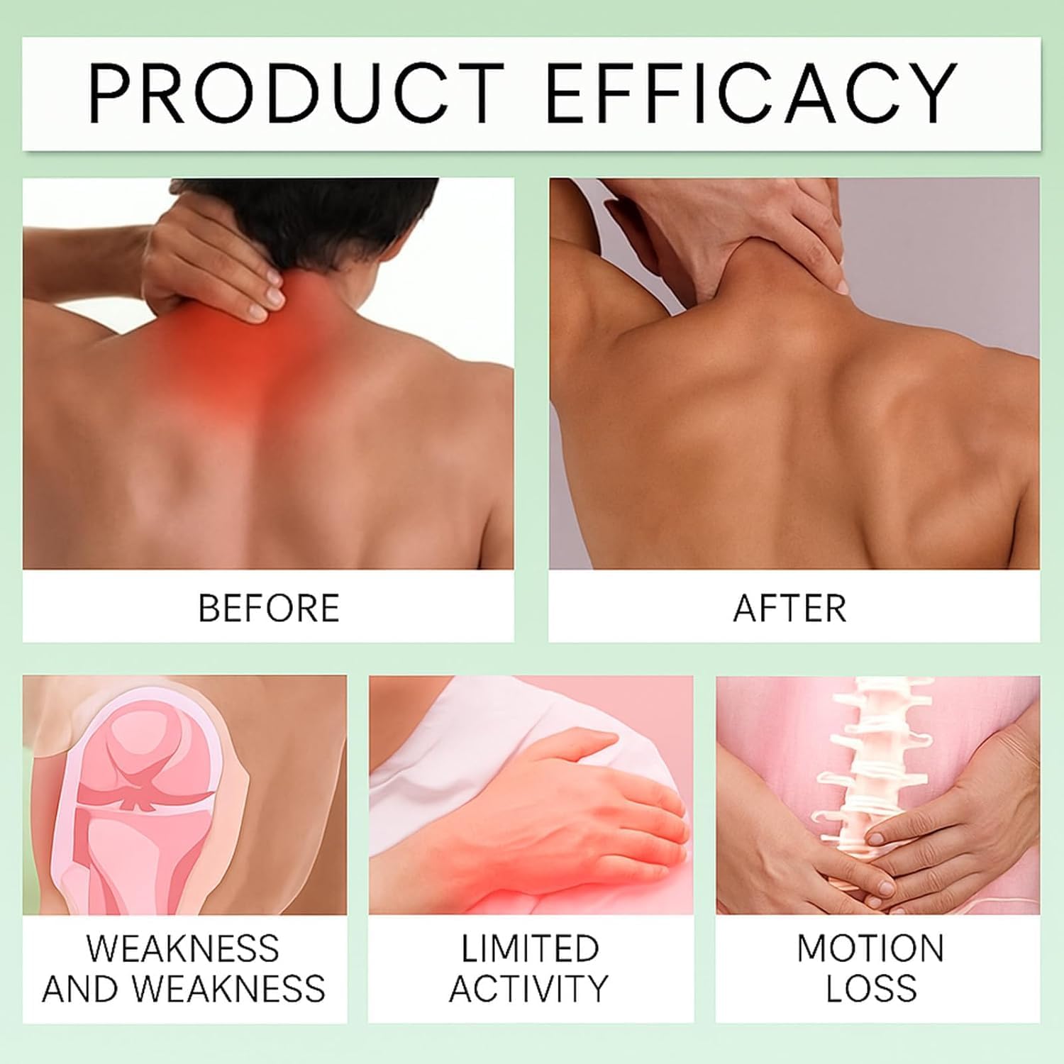 SPIANEST NMD Arnica Cream Application demonstrates fast-absorbing soothing care.