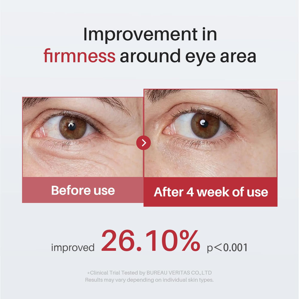 SPODARE suitable for all skin types, including sensitive skin.