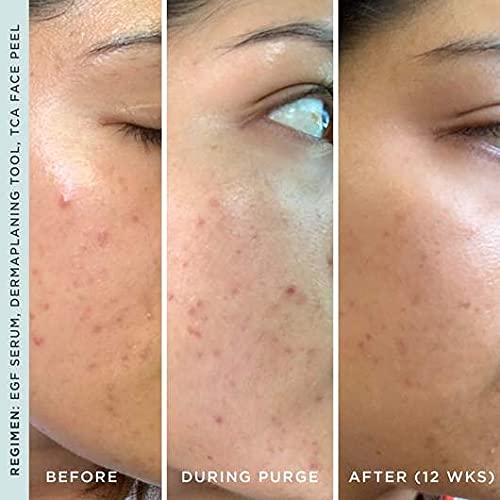 StackedSkincare Hydrating EGF Serum glow finish hints at natural radiance.