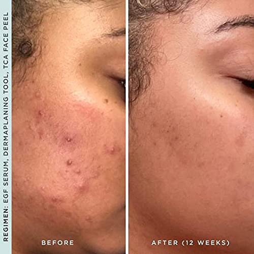 StackedSkincare Hydrating EGF Serum routine scene shows easy layering with other products.