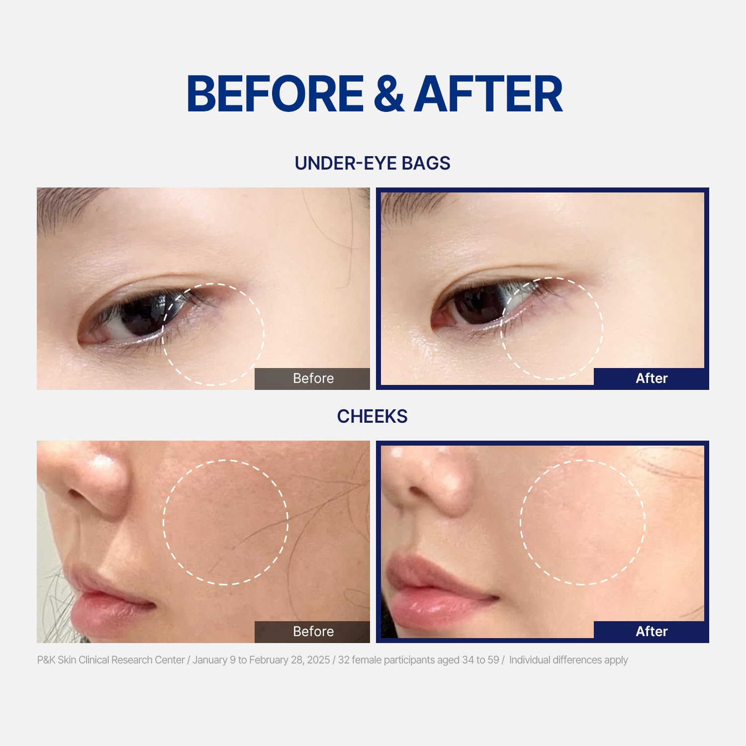 StayUth Wrinkle Spot Serum with hyaluronic-acid for lasting hydration